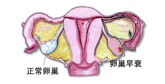 卵巢功能衰退的症状有哪些