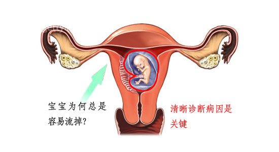 哪些原因会导致无胎心胎芽